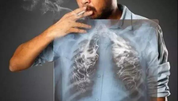 肺年龄-戒烟-烟民-呼吸检测-肺病-呼吸训练-康复