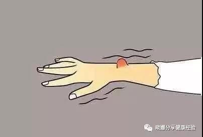 哮喘-慢阻肺-咳嗽-咳喘-支气管炎-肺功能检测仪-呼吸训练器