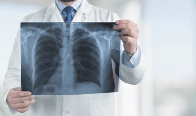 尘肺-哮喘-慢阻肺-咳嗽-咳喘-支气管炎-肺功能检测仪-呼吸训练器